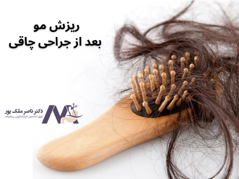 ریزش مو بعد از جراحی چاقی یکی از عوارض این عمل به حساب میآید.