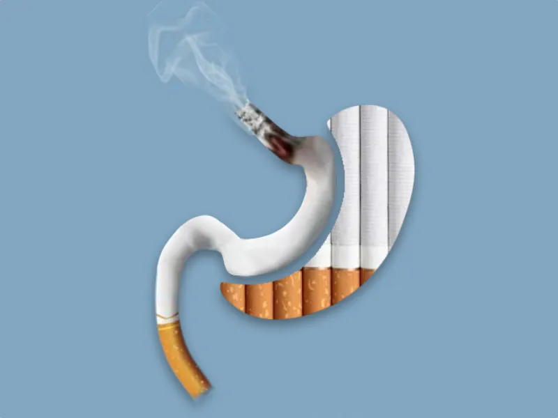 سیگار بعد از عمل اسلیو