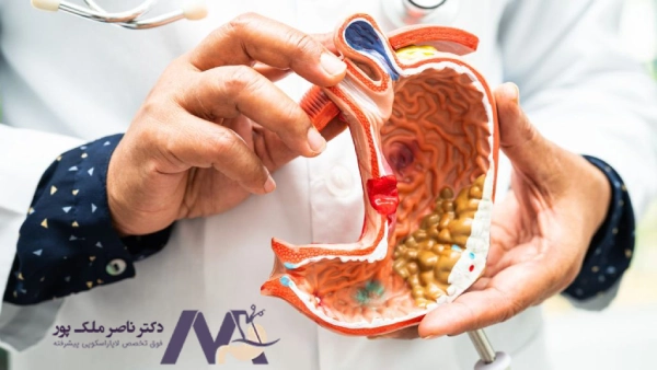 عوارض برداشتن کیسه صفرا