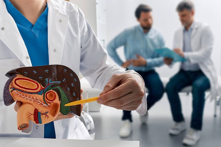 انتقال سنگ به مجرای صفراوی (Choledocholithiasis)