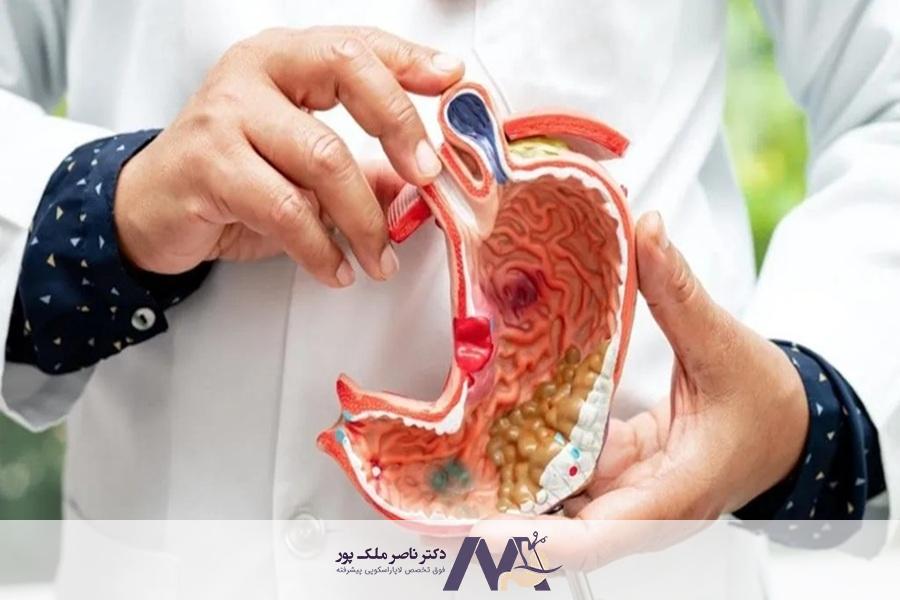 بهترین جراح بای پس معده در تهران