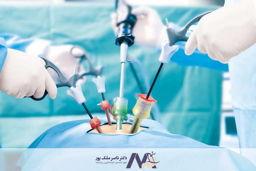 در دو هفته اول پس از جراحی حلقه معده، شما فقط مجاز به مصرف مایعات صاف و بدون قند هستید.