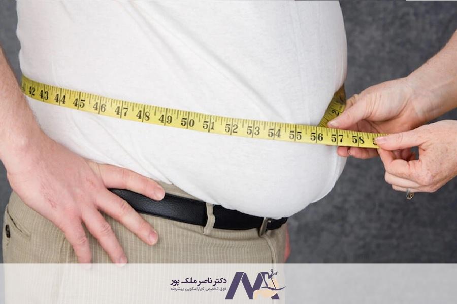 بازگشت وزن بعد از بای پس معده
