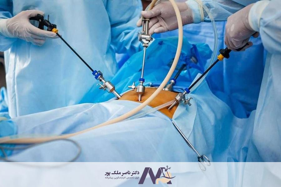 بای پس معده با بیمه