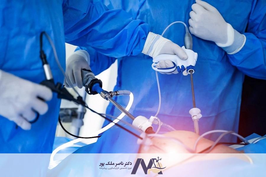 پشیمانی بعد از اسلیو معده