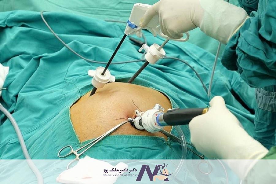 تجربه جراحی اسلیو ایمن و پیشرفته توسط دکتر ناصر ملک پور