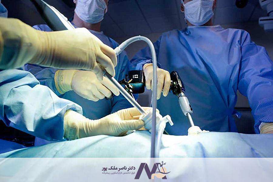 لوازم جراحی اسلیو معده