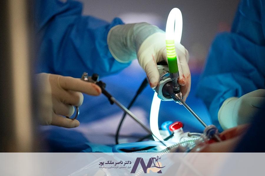 جراحی لاغری برای کبد چرب