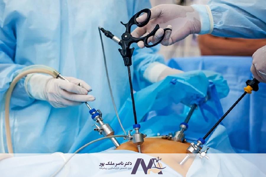 لاپاراتومی چیست