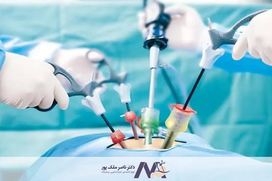 لاپاراتومی چیست