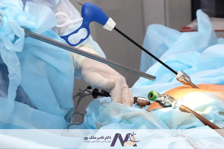 استراحت بعد از عمل لاپاراسکوپی کیسه صفرا