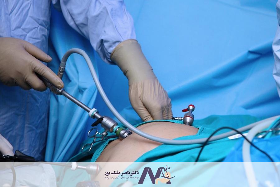 هزینه جراحی روده