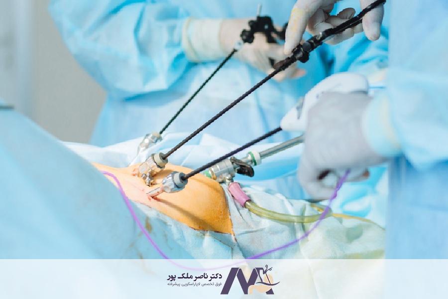هزینه لاپاراسکوپی روده