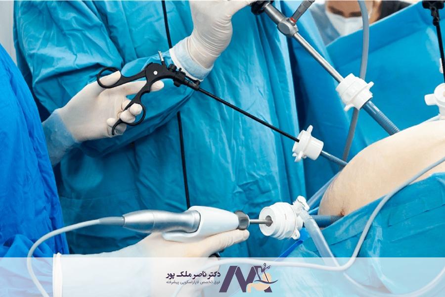 هزینه لاپاراسکوپی روده